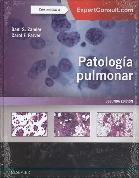 Patología pulmonar + ExpertConsult (2ª ed.)