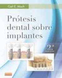Prótesis dental sobre implantes (2ª ed.)
