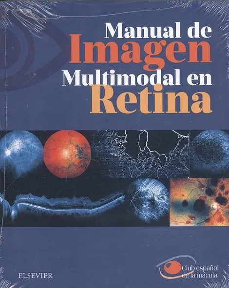 Manual de imagen multimodal en retina
