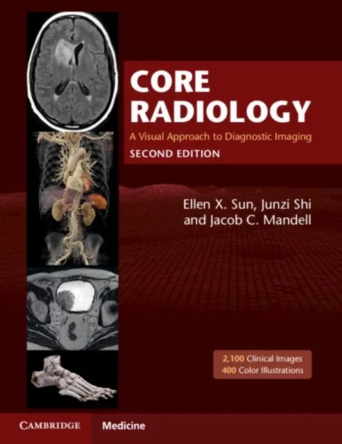 CORE RADIOLOGY : A VISUAL APPROACH TO DIAGNOSTIC IMAGING