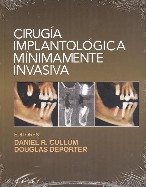 Cirugía implantológica mínimamente invasiva
