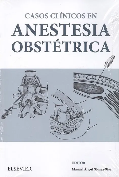 Casos Clínicos en anestesia obstétrica