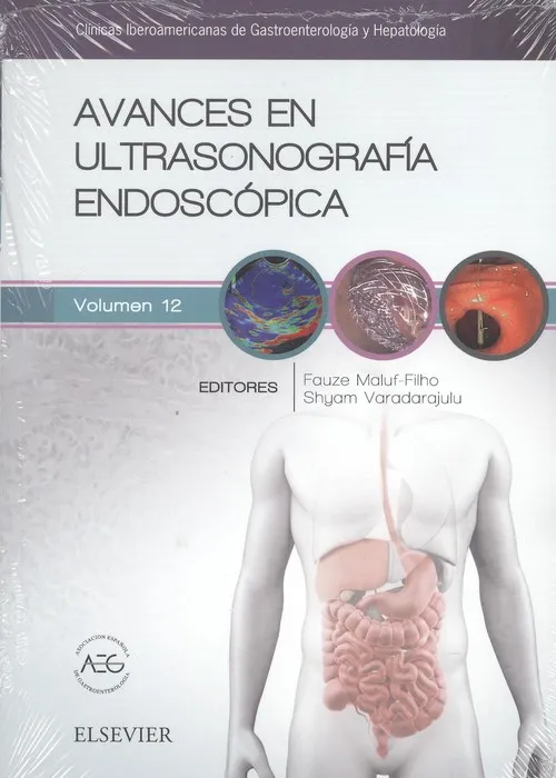 Avances en ultrasonografía endoscópica