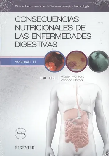 Consecuencias nutricionales de las enfermedades digestivas