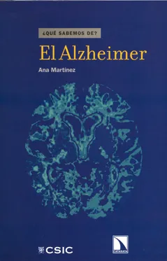 ALZHEIMER,EL