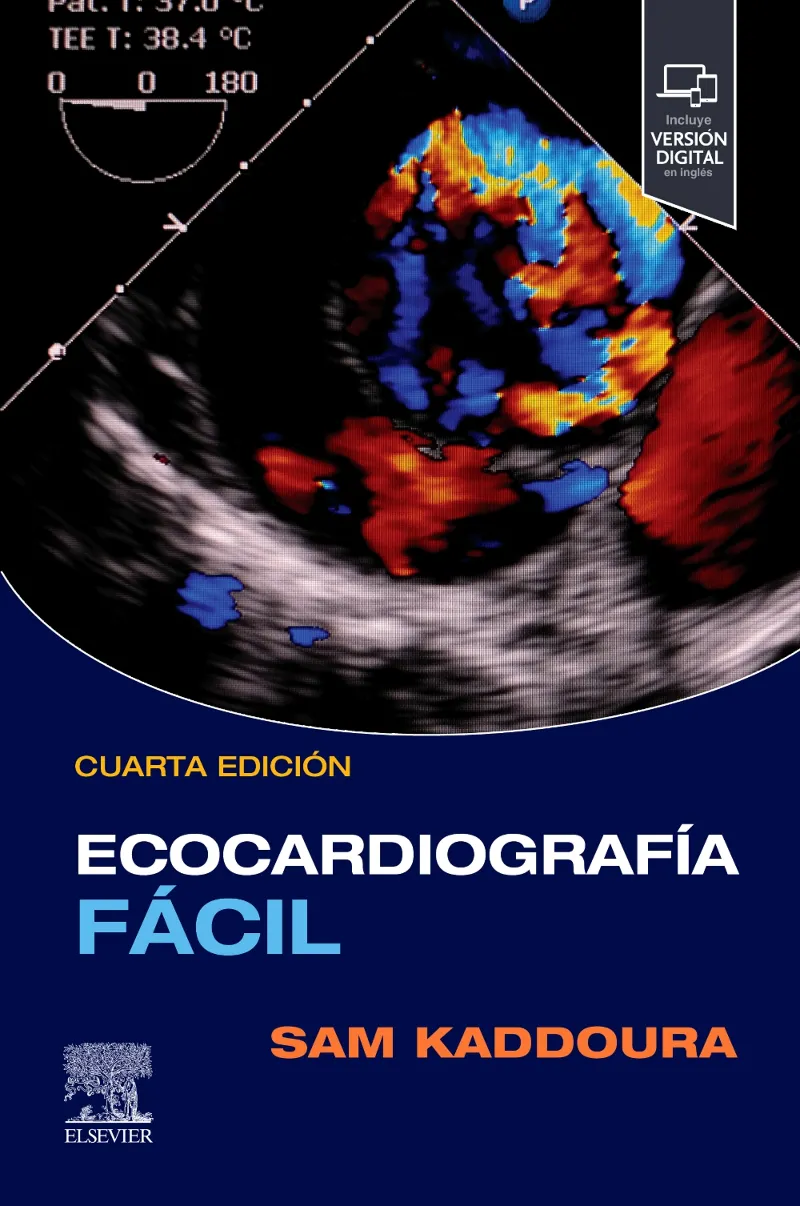 ECOCARDIOGRAFÍA FÁCIL