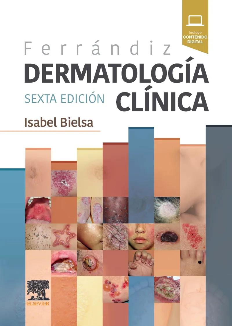 FERRÁNDIZ. DERMATOLOGÍA CLÍNICA