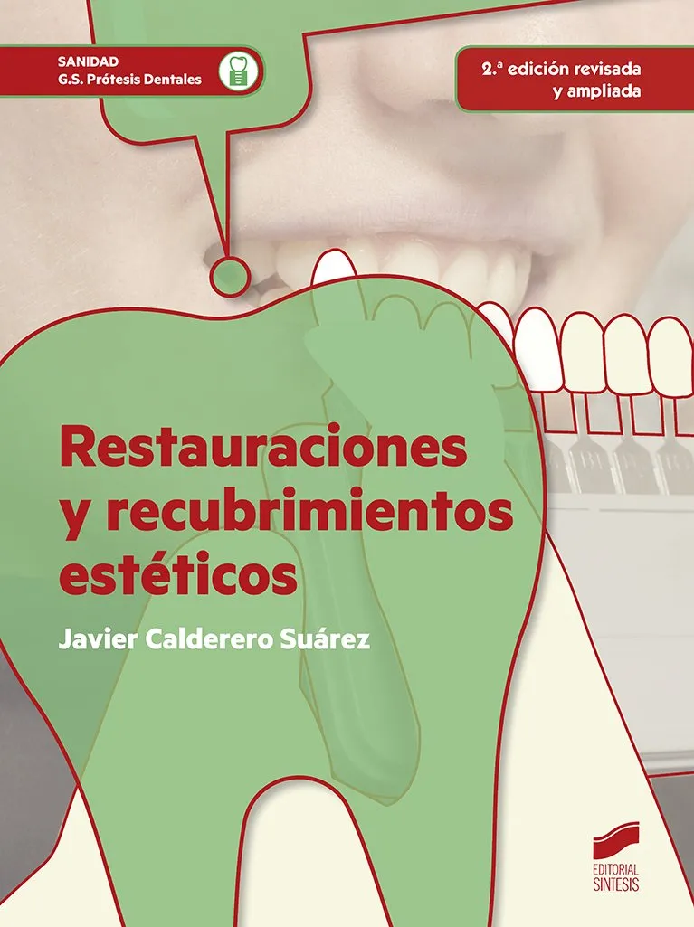 Restauraciones y recubrimientos estéticos