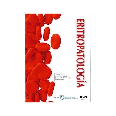 ERITROPATOLOGÍA(2ª EDICIÓN)